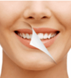 הלבנת שיניים: איך עושים זאת בקלות ובמהירות?-תמונה